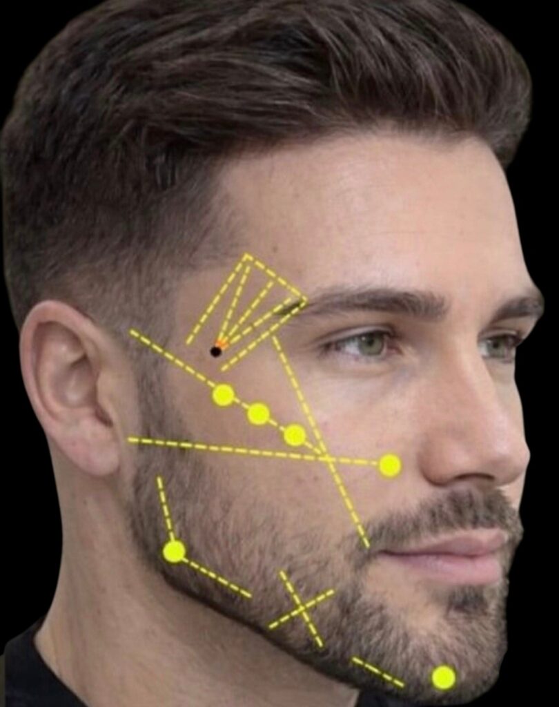 Mappatura del volto maschile per armonizzazione facciale